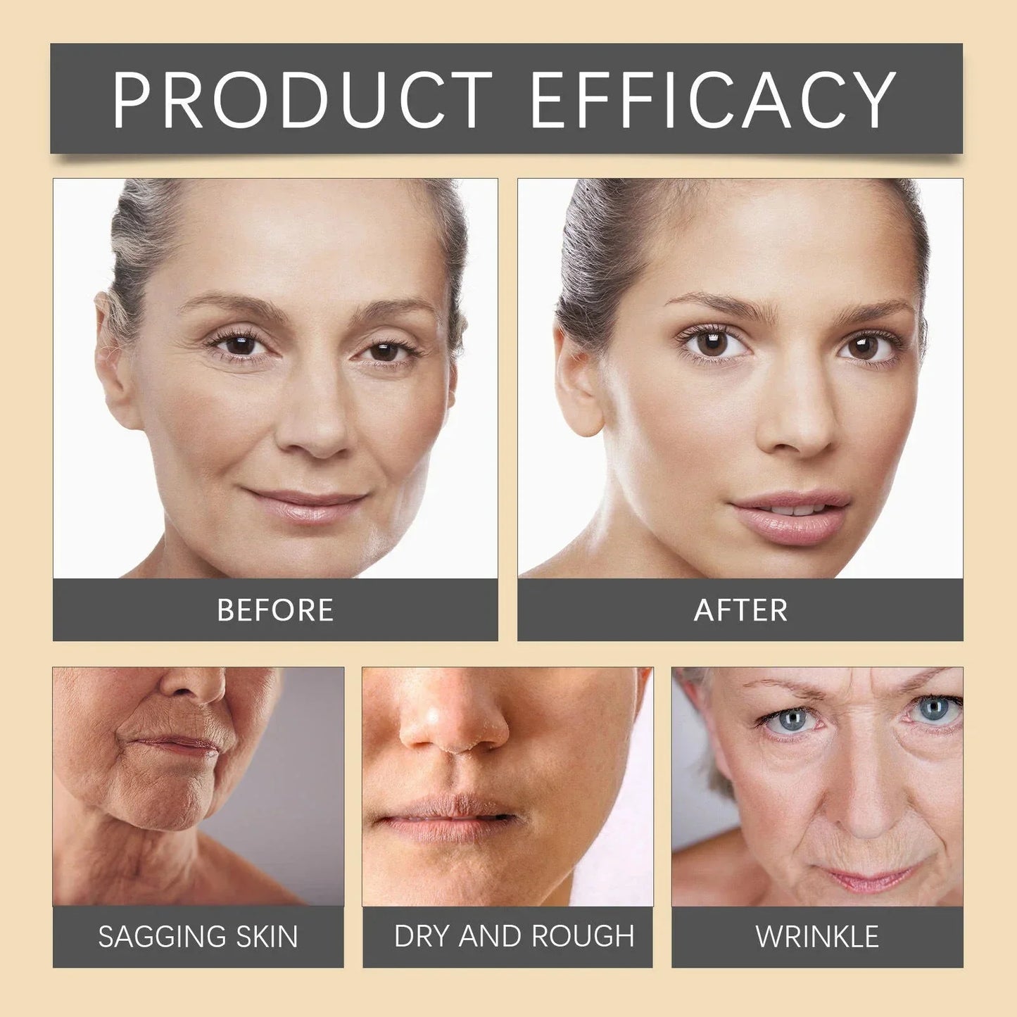 Botox Bee Venom Wrinkle Removal Cream ( Buy 1 Get 1 Free )